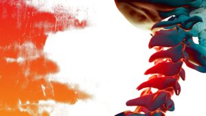 Disección Cervical en el Hospital Virgen de Macarena