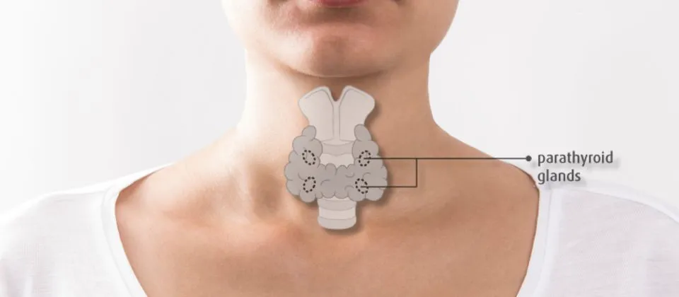 nódulos tiroideos y paratiroideos con radiofrecuencia