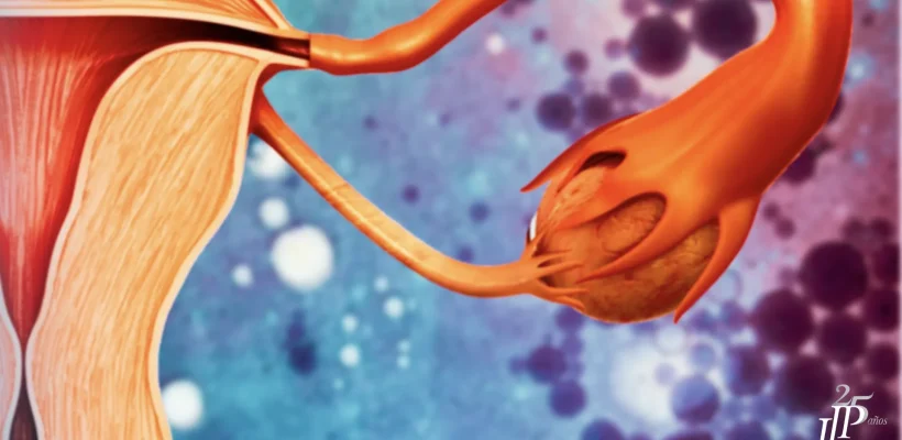 eliminar miomas sin cirugía